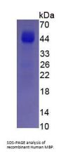 Human Myelin Basic Protein (MBP) Protein