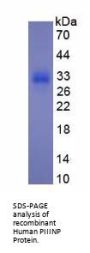 Human Procollagen Type III N-Terminal Propeptide (PIIINP) Protein