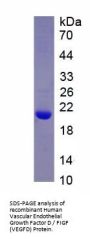 Human Vascular Endothelial Growth Factor D / FIGF (VEGFD) Protein
