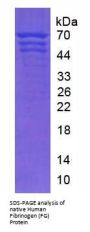 Human Fibrinogen (FG) Protein
