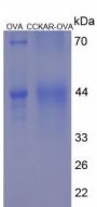 Human Cholecystokinin A Receptor (CCKAR) Peptide (OVA)