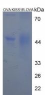 Human KISS1 Receptor (KISS1R) Peptide (OVA)