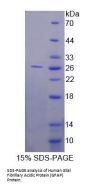 Human Glial Fibrillary Acidic Protein (GFAP) Protein