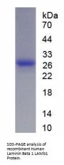 Human Laminin Beta 1 (LAMb1) Protein