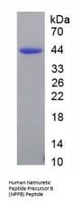 Human Natriuretic Peptide Precursor B (NPPB) Protein