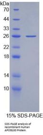 Human Apolipoprotein B-100 (APOB100) Protein