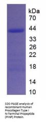 Human Procollagen Type I N-Terminal Propeptide (PINP) Protein