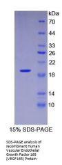 Human Vascular Endothelial Growth Factor 165 (VEGF165) Protein