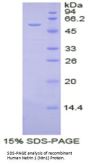 Human Netrin 1 (NTN1) Protein