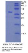 Human Cyclin Dependent Kinase 2 (CDK2) Protein