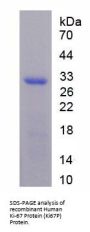 Human Proliferation Marker Protein Ki-67 (MKI67) Protein