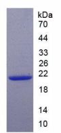 Mouse Cyclin Dependent Kinase Inhibitor 1A (CDKN1A) Protein
