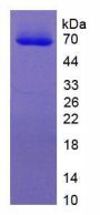 Human Microphthalmia Associated Transcription Factor (MITF) Protein