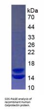 Human Calprotectin Protein