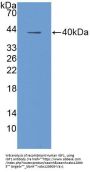 Human Insulin Like Growth Factor 1 (IGF1) Protein (Active)