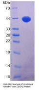 Human Insulin Like Growth Factor 1 (IGF1) Protein (Active)