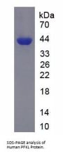 Human Phosphofructokinase, Liver (PFKL) Protein