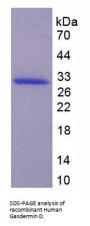 Human Gasdermin D (GSDMD) Protein