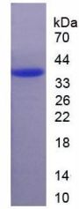 Human 11-Beta-Hydroxysteroid Dehydrogenase Type 2 (HSD11B2) Protein