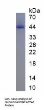 Actin, Alpha Skeletal Muscle (ACTA1) Protein