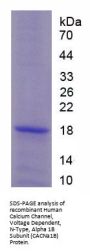 Human Calcium Channel, Voltage Dependent, N-Type, Alpha 1B Subunit (CACNa1B) Protein