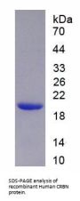 Human Cereblon (CRBN) Protein