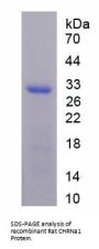 Rat Cholinergic Receptor, Nicotinic, Alpha 1 (CHRNa1) Protein