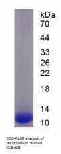 Human Claudin 18 (CLDN18) Protein
