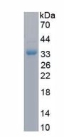 Human Collagen Type XIII Alpha 1 (COL13A1) Protein