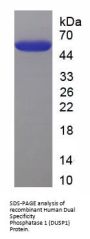 Human Dual Specificity Phosphatase 1 (DUSP1) Protein