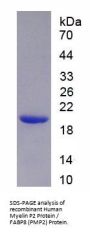 Human Myelin P2 Protein / FABP8 (PMP2) Protein