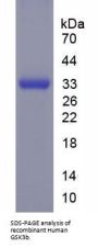 Human Glycogen Synthase Kinase 3 Beta (GSK3b) Protein