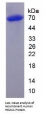 Human Histone Deacetylase 1 (HDAC1) Protein