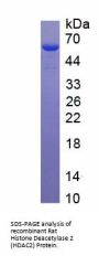 Rat Histone Deacetylase 2 (HDAC2) Protein