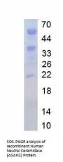Human Neutral Ceramidase (ASAH2) Protein