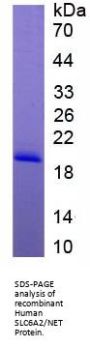 Human Sodium-Dependent Noradrenaline Transporter (SLC6A2) Protein