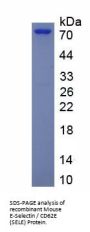 Mouse E-Selectin / CD62E (SELE) Protein