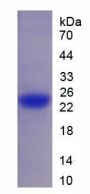 Mouse Spermidine/Spermine N1-Acetyltransferase 1 (SAT1) Protein