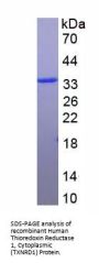 Human Thioredoxin Reductase 1, Cytoplasmic (TXNRD1) Protein