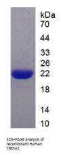 Human Triggering Receptor Expressed On Myeloid Cells 2 (TREM2) Protein