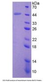 Human Bone Morphogenetic Protein 2 (BMP2) Protein (Active)
