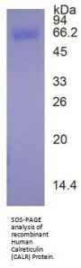 Human Calreticulin (CALR) Protein (Active)