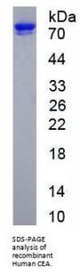 Human Carcinoembryonic Antigen-Related Cell Adhesion Molecule 5 (CEACAM5) Protein (Active)