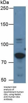 Human Carcinoembryonic Antigen-Related Cell Adhesion Molecule 5 (CEACAM5) Protein (Active)