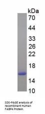 Human Fatty Acid Binding Protein 4, Adipocyte (FABP4) Protein (Active)
