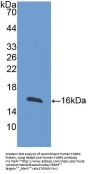 Human Fatty Acid Binding Protein 4, Adipocyte (FABP4) Protein (Active)