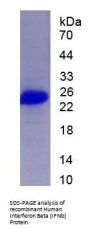 Human Interferon Beta (IFNb) Protein (Active)