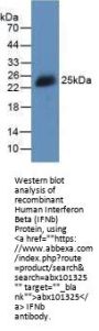 Human Interferon Beta (IFNb) Protein (Active)