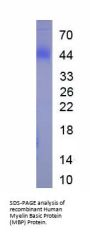 Human Myelin Basic Protein (MBP) Protein (Active)