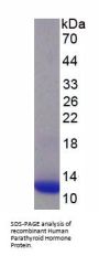 Human Parathyroid Hormone (PTH) Protein (Active)